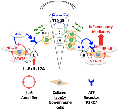 The inflammation signal (IL-6 amplifier) in the affected joint (L) causes the secretion of ATP that transmits a signal through t