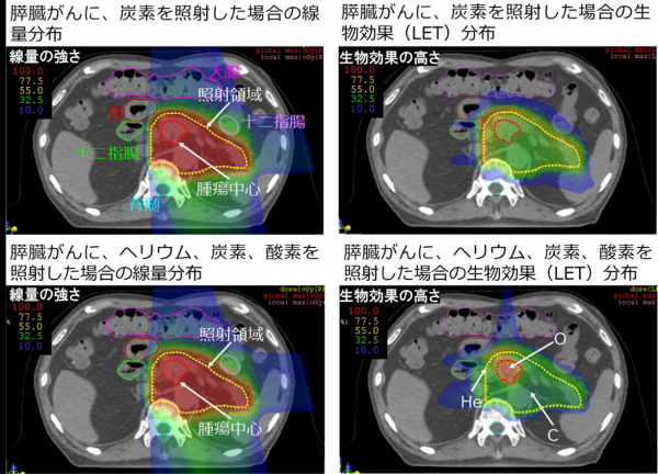 図2　膵臓がんに、炭素イオン単独で照射した場合(上段)と、ヘリウムイオン(He)、炭素イオン(C)、酸素イオン(O)のマルチイオン照射した場合(下段)の線量分布(左列)とLET分布(右列)をCT画像上に示したシミュレーション結果