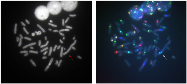 A tricentric chromosome 