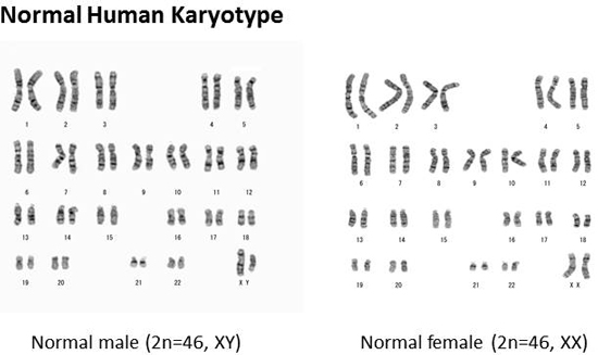 G-banded chromosomes