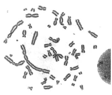 Chromosome aberrations induced by high-dose (5 Gy)