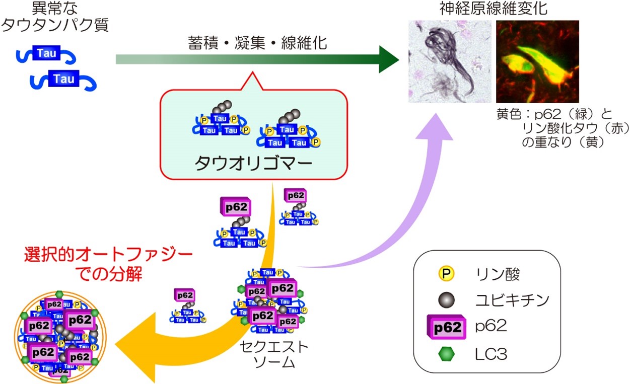 p62を介した選択的オートファジーがタウオリゴマーをとりのぞくしくみ