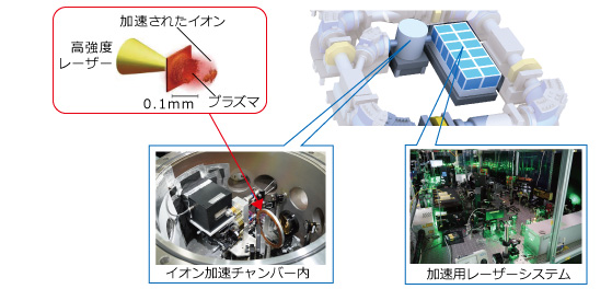 量子メス