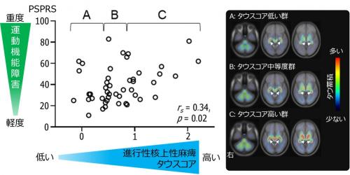 図４　脳内タウ蓄積と運動および認知機能の障害の関連