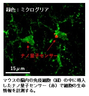 ミクログリア＆ナノダイヤ画像