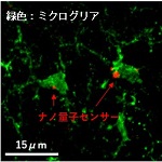 ミクログリアとナノセンサー画像