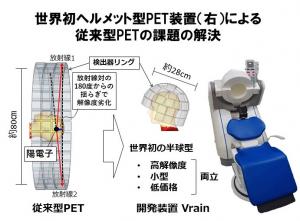 ヘルメット型PET装置による従来型PETの課題解決
