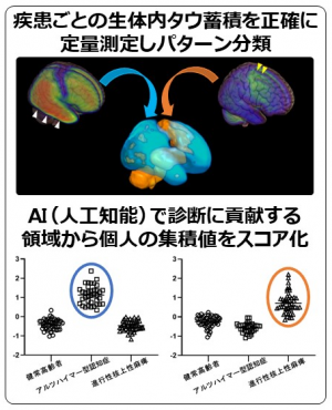 疾患ごとに生体内タウ蓄積て医療測定し分類したパターンからAIで個人の集積値をスコア化