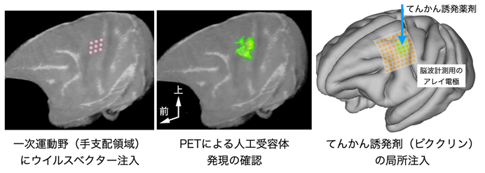 （左）人工受容体遺伝子をもったウイルスベクターの注入位置（ピンクの点）の模式図。 （中）人工受容体に結合したPET薬剤から放射される信号の集積部位（緑）を示すPET画像。人工受容体の発現が一次運動野で確認できた。（右）一次運動野をカバーする脳波計測用アレイ