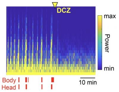 Title: Chemogenetic attenuation of cortical seizures.