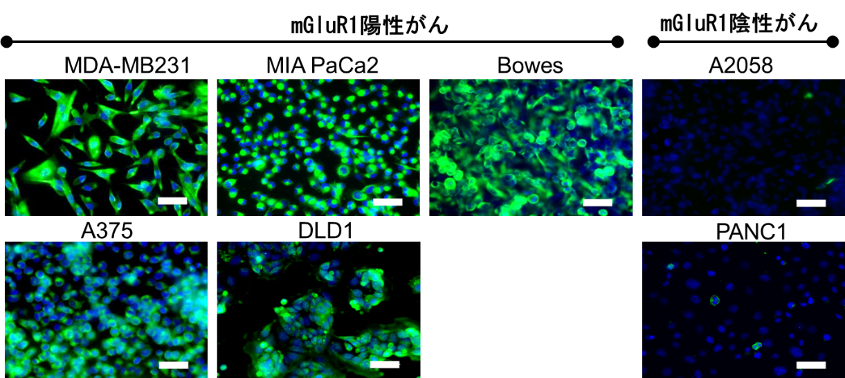 各種がん細胞株におけるmGluR1発現