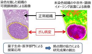 レーザー医療応用図2