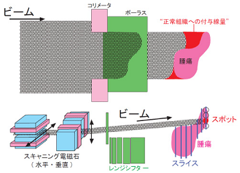 図4　3次元スキャニング照射の模式図の画像