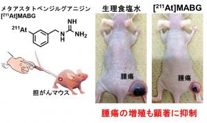 悪性褐色細胞腫治療薬の開発