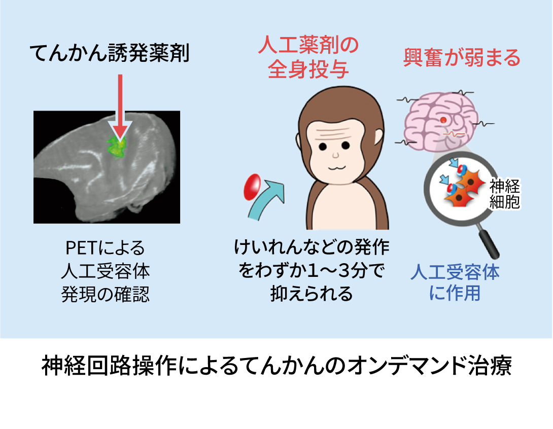 オンデマンド治療