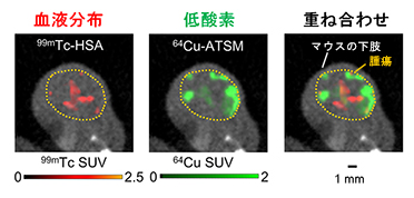 SPECT/PET/CT画像