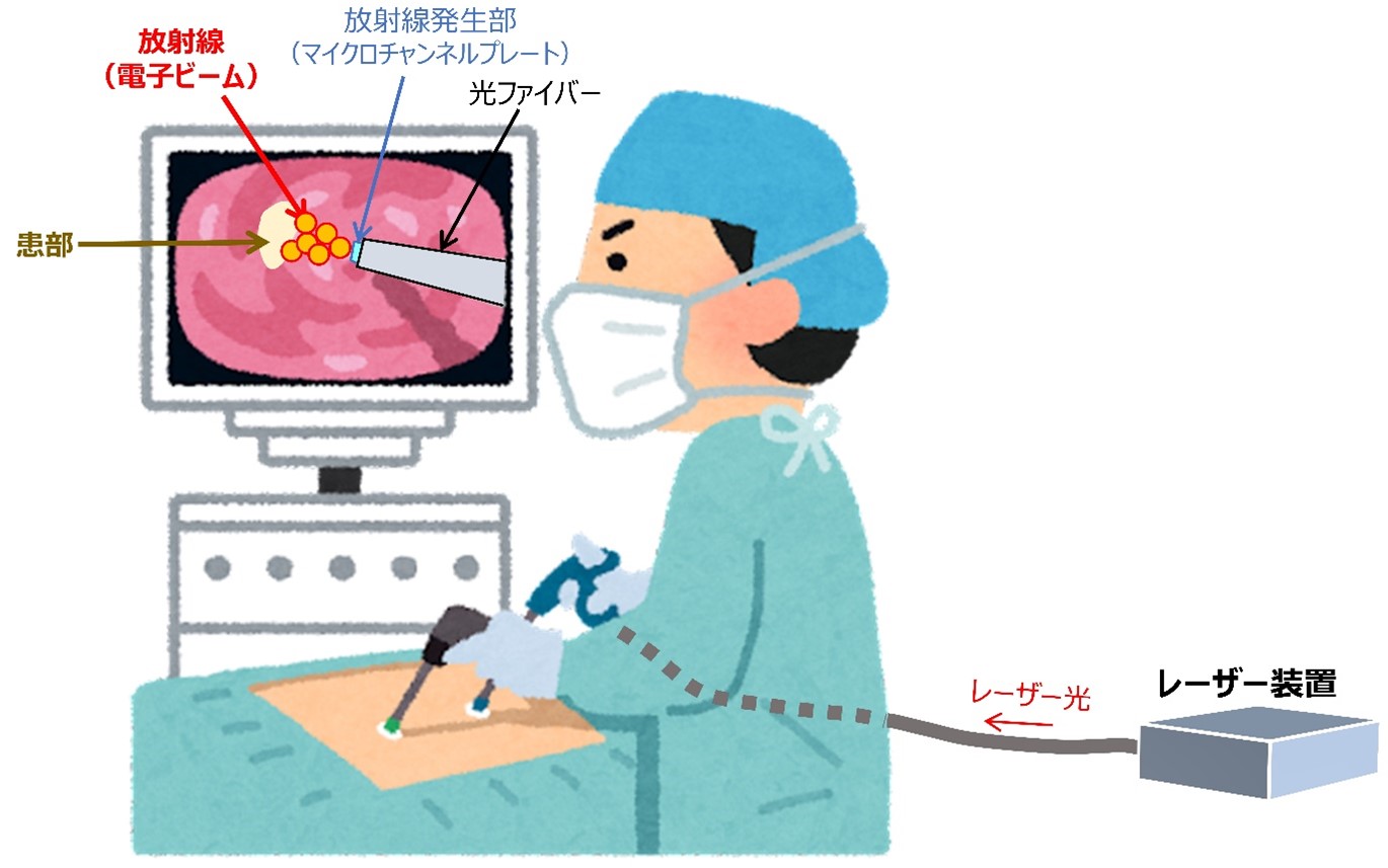 本技術を活用した内視鏡型放射線がん治療のイメージ