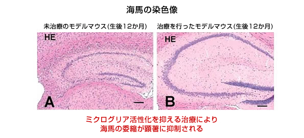 免疫抑制剤の効果