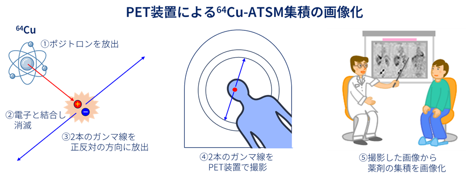 かっぱー64集積の画像化