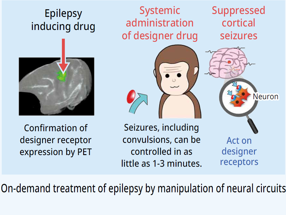 On-demand treatment of epilepsy by manipulation of neural circuits