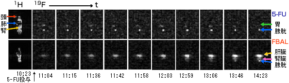 複数周波数選択同時画像法で得た5-FU(上段)と代謝生成物FBAL(下段)体内分布の時間経過(冠状断面)