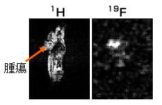 Fnuc信号選択画像法で得た腫瘍の位置での有効代謝生成物Fnucの生成
