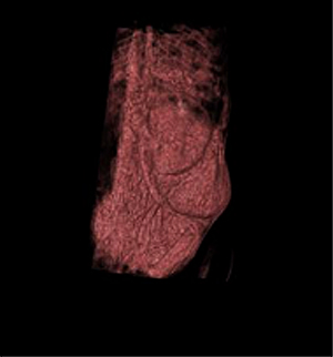 マウスがん3次元画像を腹腔内から観察