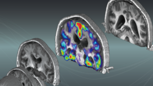 cross-sectional view of the brain