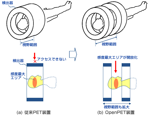 従来のPET装置(左)と新たに開発した開放型OpenPET装置(右)