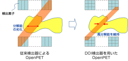 DOI検出器との組み合わせによる効果