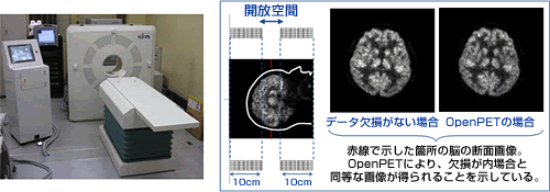 次世代PET装置jPET-D4」(左)を用いた開放型PET装置「OpenPET」の実験結果(右)