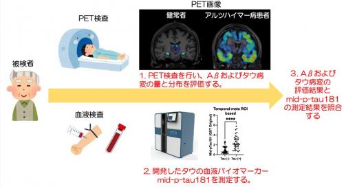 PET検査や血液検査のイラスト