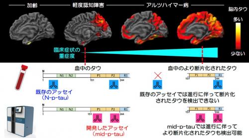タウ蛋白の脳内分布の広がり