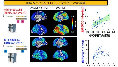 血液検査とPET検査で検出したタウ蛋白の値とその相関を示したグラフ
