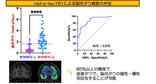 血中タウにより、脳のタウ蓄積の有無を区別できるかを検証した解析結果