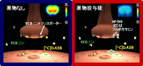 PETを用いた脳内セロトニントランスポーター占有率測定