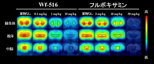 [11C]DASB を用いたラット脳内セロトニントランスポーターのPETイメージング画像