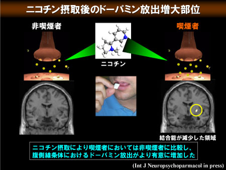 ニコチン摂取後の喫煙者はドーパミン放出が非喫煙者より有意に増加したことを示す脳領域