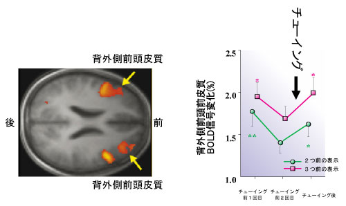 作業記憶のテストを行っている時のBOLD信号の変化