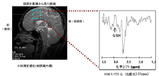 GSH測定部位とGSHスペクトル