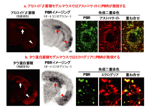 アルツハイマー病モデルマウスにおけるPBR発現パターン