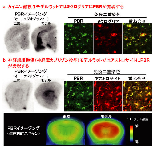 認知症以外の神経病態モデルにおけるPBRの発現パターンとPET画像