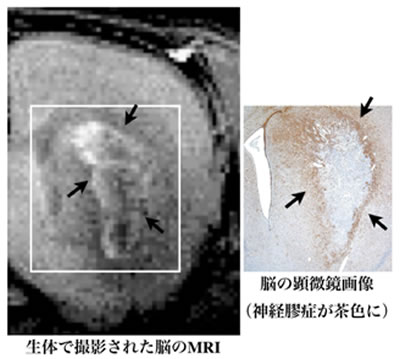 MRI像 (左) では脳梗塞が起きた場所を取り囲むように環状に 白く造影された。死後の組織染色像 (右) と比較して、その部位が神経膠症であることを確認した。高磁場MRIでは、 脳梗塞の傷害部位を100ミクロン程度の精度で画像化できる。