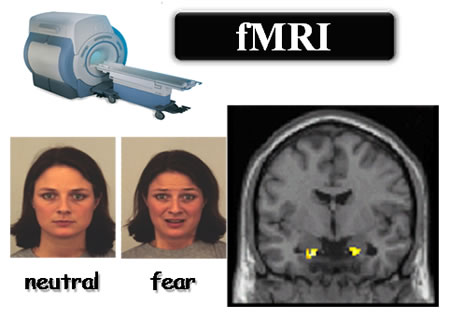ｆMRIによる恐怖の表情の顔写真を見た時の扁桃体の活動の計測。