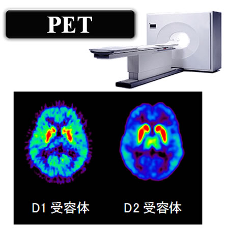 PETによる脳内のドーパミンD1受容体およびD2受容体の計測