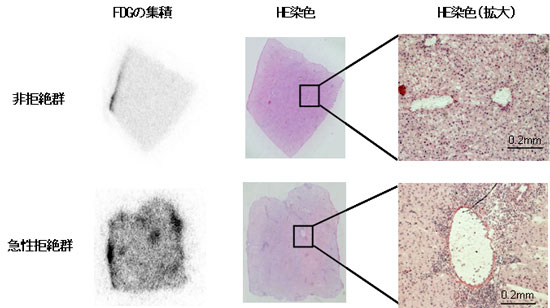 肝臓のFDG の集積とヘマトキシリン・エオジン