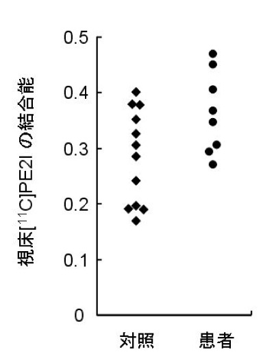 健常対照群と統合失調症患者群の視床への[11C]PE2Iの結合能