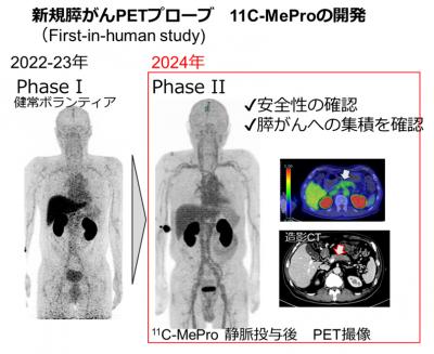 開発した膵臓癌PETプローブの体内集積画像