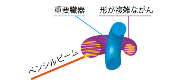3次元スポットスキャニング照射方法の概念図の画像
