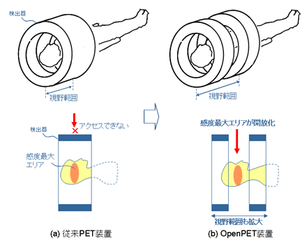 従来のPET装置(左)と開放型OpenPET®装置(右)の比較